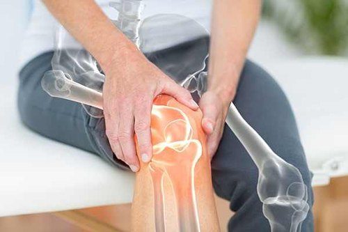 Joint Disorders