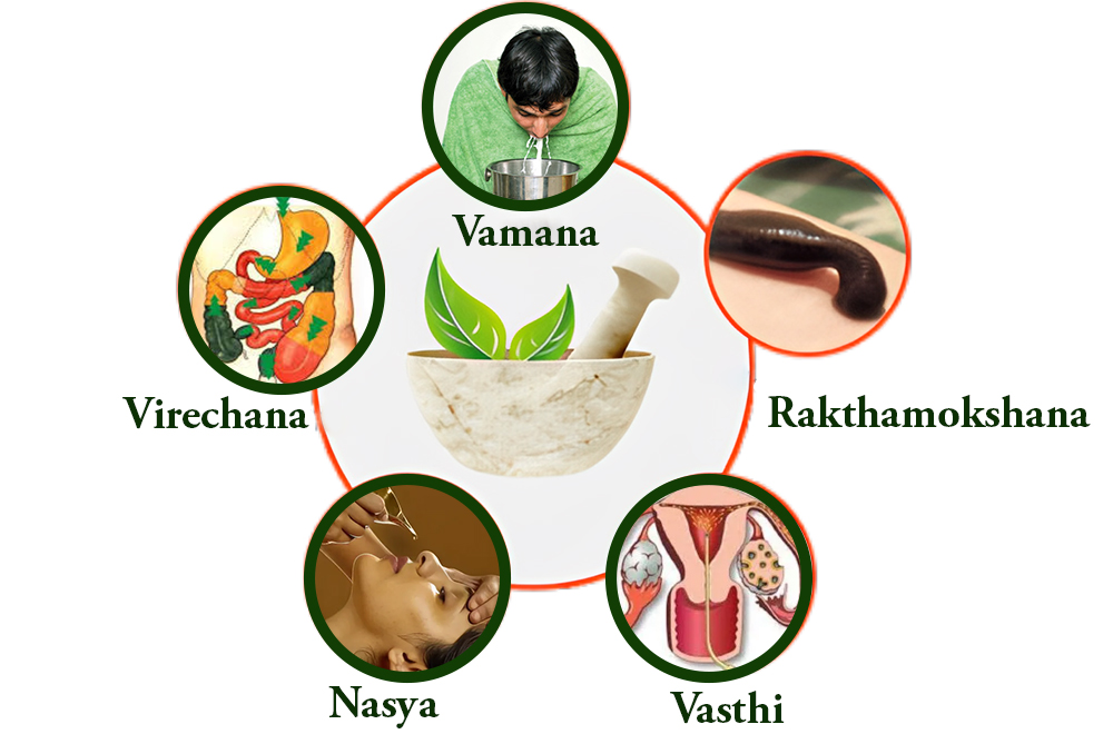 What Role Does Panchakarma Play in Ayurvedic Weight Management in Hyderabad